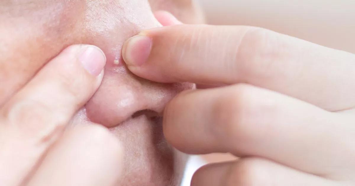 Emergency Warning When your face pops can kill you |Bristol Live
